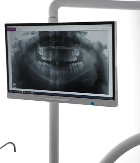 a dental x-ray