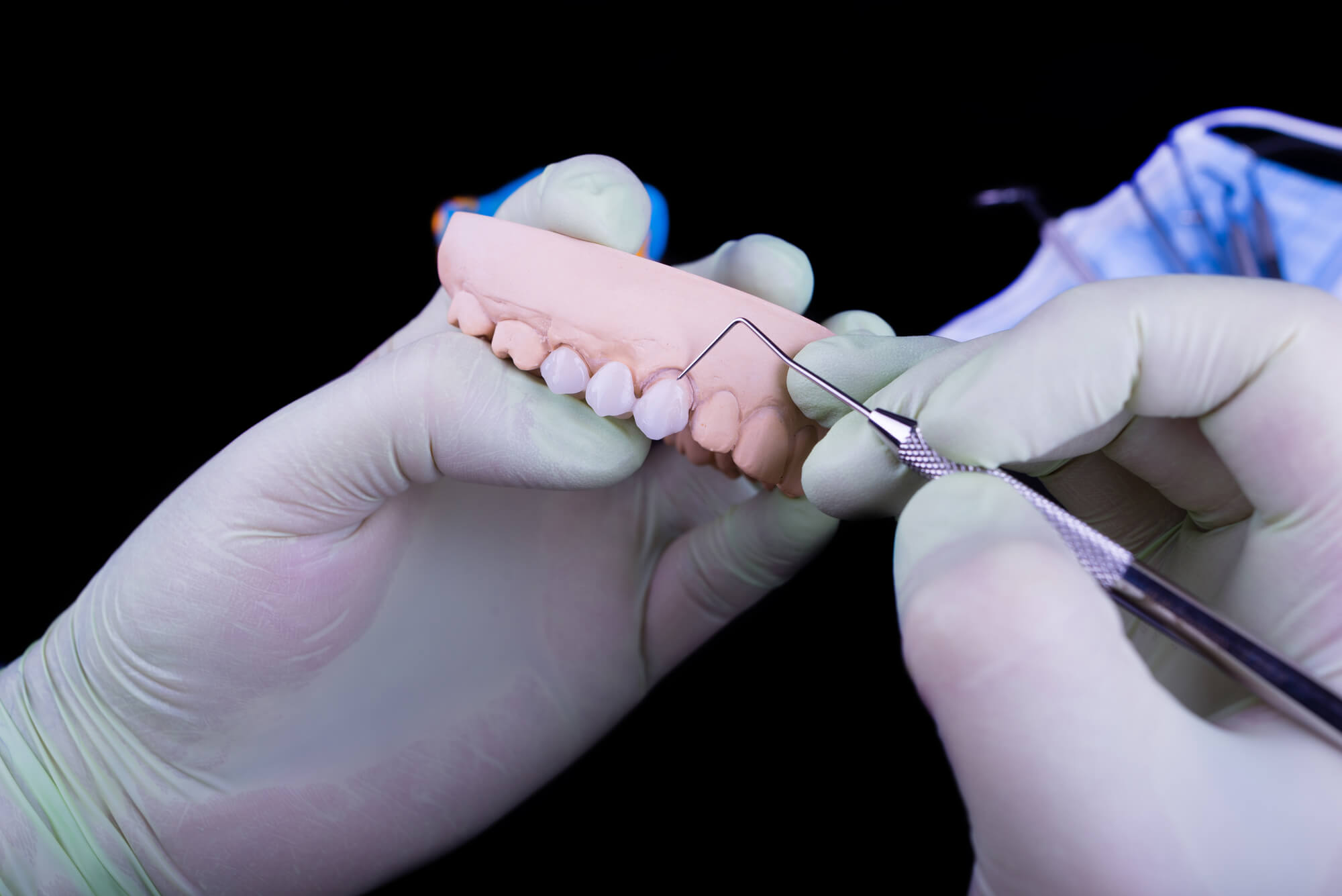 An specialist working on dentures in crystal river fl